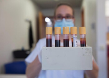 Coronavirus: un altro morto in Vda, guariti sono 675