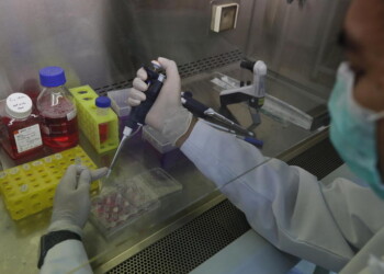 Coronavirus: un caso positivo in più in Valle d’Aosta