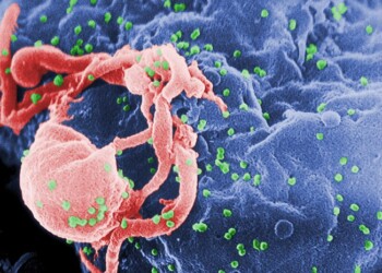 virus Hiv nuova variante