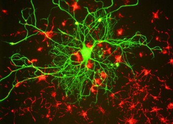 Nel cervello una molecola anti-età che aiuta la memoria