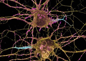 Parkinson, un nuovo bersaglio per ridurre gli effetti collaterali delle terapie
