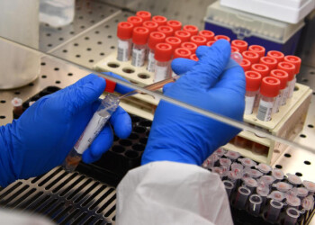 Coronavirus: 1 positivo in Campania