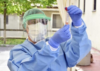 Coronavirus, 10 ricoverati, 5.330 dimessi/guariti