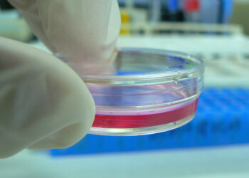 Coronavirus, gli anticorpi di precisione utili come il vaccino