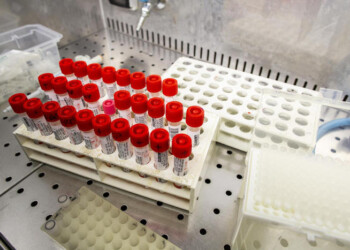 Coronavirus: Marche, un positivo su 638 tamponi nuove diagnosi