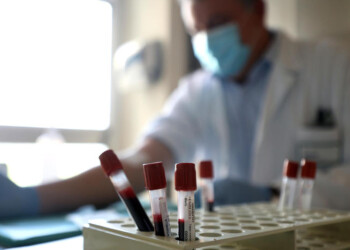 Coronavirus: Marche, un positivo su 694 nuove diagnosi