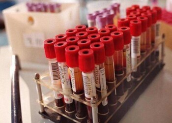 In Toscana no vittime ultime 24 ore