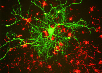 Nanoparticelle d’oro salva-neuroni aprono a nuove terapie