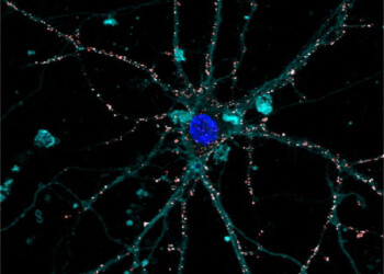 Ottenuta in Italia la prima protesi liquida della retina