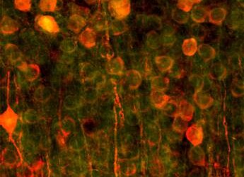 Ottenuto un odore artificiale, ‘dialoga’ con il cervello
