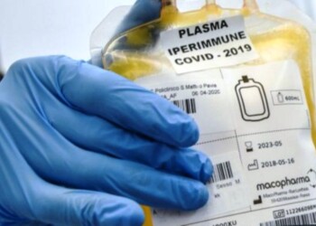 Procedura urgente per DDL su banca dati plasma