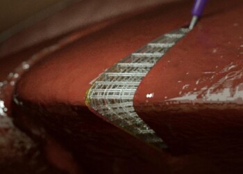 Tessuti stampati in 3D direttamente nel corpo umano