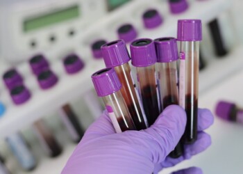 Verso un Osservatorio globale del sangue, per fermare le pandemie