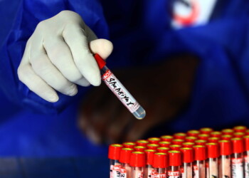 5 nuovi positivi in Liguria