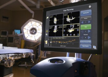 Chirurgia ortopedica robotica: in sala operatoria l’innovazione del sistema NAVIO per artrosi e protesi del ginocchio.