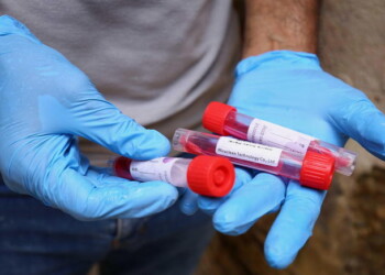 Coronavirus: anche oggi in Calabria un positivo in più
