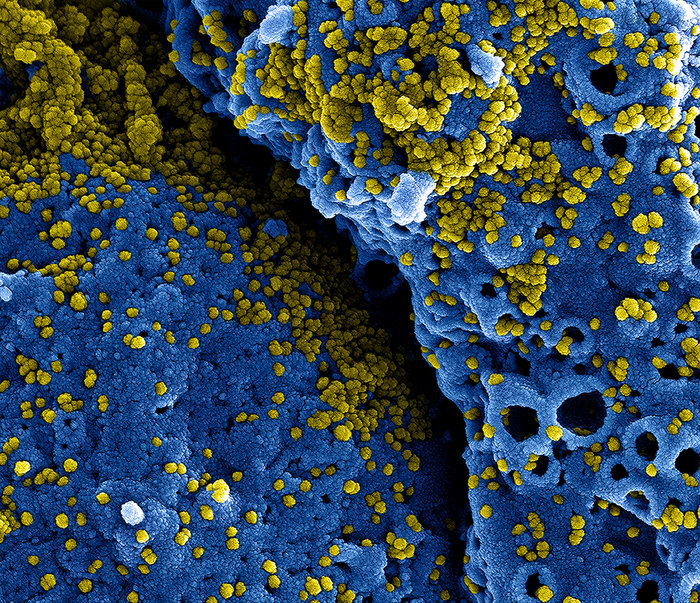 Coronavirus, negli anticorpi un gene cruciale per il vaccino