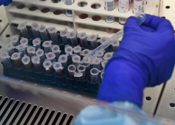 Coronavirus: nessun morto e 33 nuovi casi in Emilia Romagna