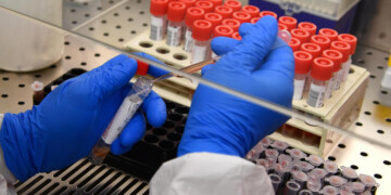 Coronavirus: in Basilicata 229 tamponi, tutti negativi