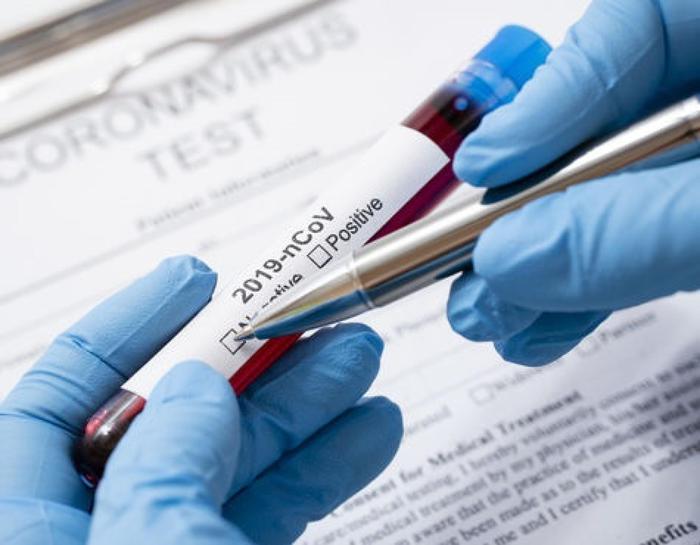 Dentista positivo, 76 tamponi negativi su 91