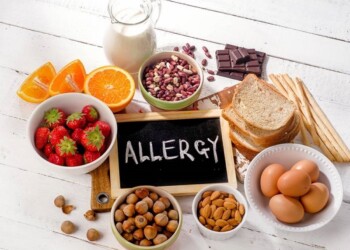 Agriturist Alessandria: allergie alimentari, buone pratiche  per chi somministra pasti o merende
