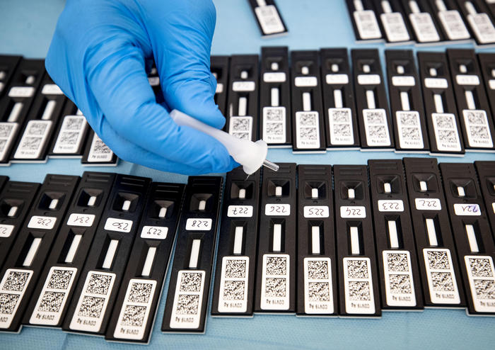 Coronavirus:test salivari e ricerca rapida virus attendibili