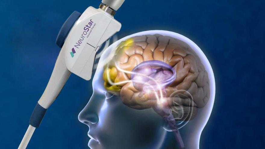 L’elettricità che fa bene al cervello Ecco le terapie a base di mini-scariche “Nuove frontiere, dalla dislessia ai tumori”