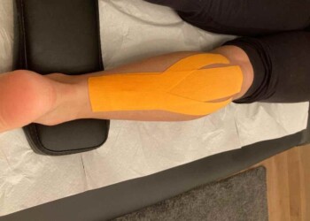 E’ davvero efficace il Kinesiotaping?