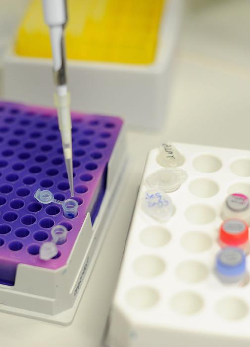 Con taglia e cuci Dna più vicina terapia per malattia rara