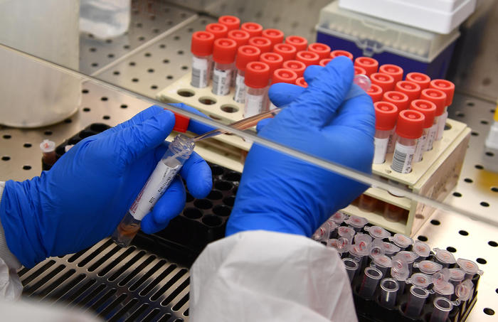 Covid: staminali per curare pazienti, al via studio a Modena