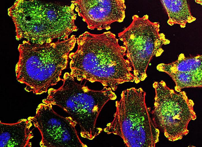 Scoperto il ‘tallone d’Achille’ delle cellule tumorali