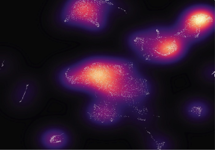 Scoperto perchè il farmaco contro il tumore alla vescica funziona solo sul 40% dei pazienti