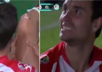 Unai Bilbao, infortunio shock al ginocchio: cade su un chiodo a bordocampo!