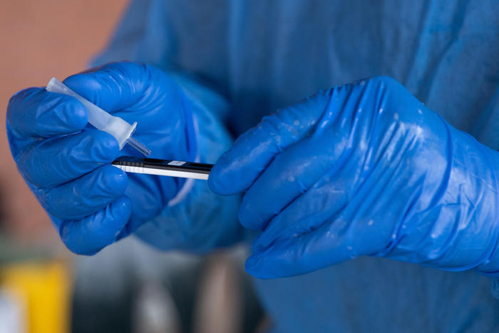 Covid: 7.970 i positivi, 307 vittime nelle ultime 24 ore