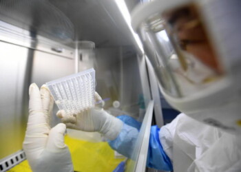 virus sfuggito da laboratorio USA o Wuhan?