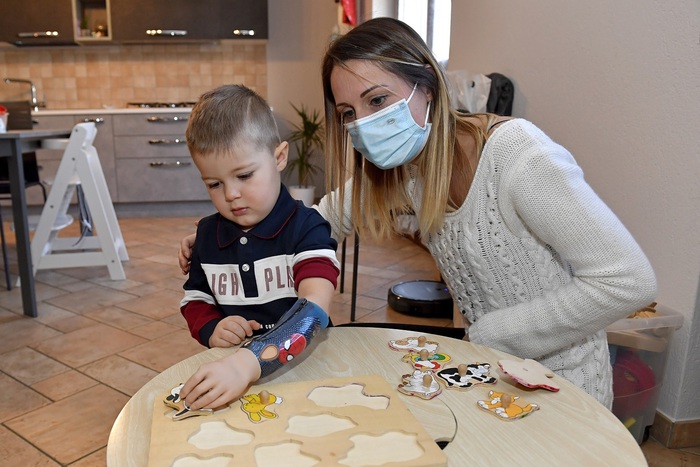 Protesi mioelettrica restituisce la mano a un bimbo di tre anni