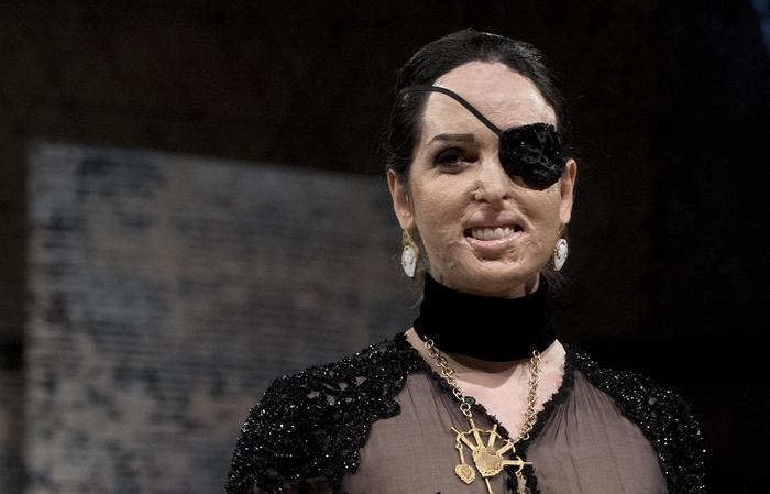 Cassazione, niente sconto per chi ‘punisce’ ex con acido