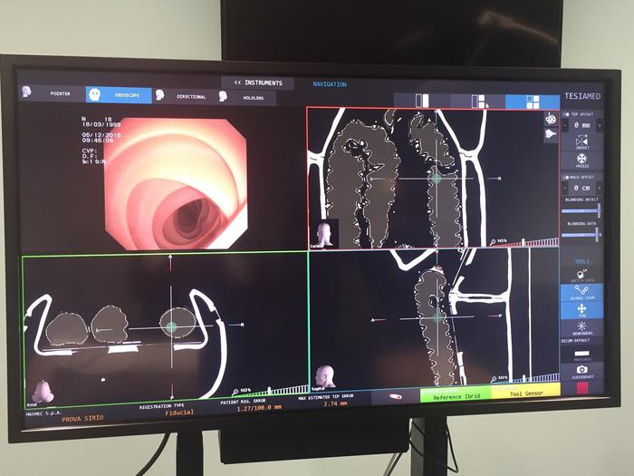 All’ospedale Negrar protesi ortopediche con realtà aumentata