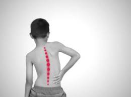 SCOLIOSI, FIORE (FIMP- SIPPS): AUMENTATI CASI PER MANCATE DIAGNOSI