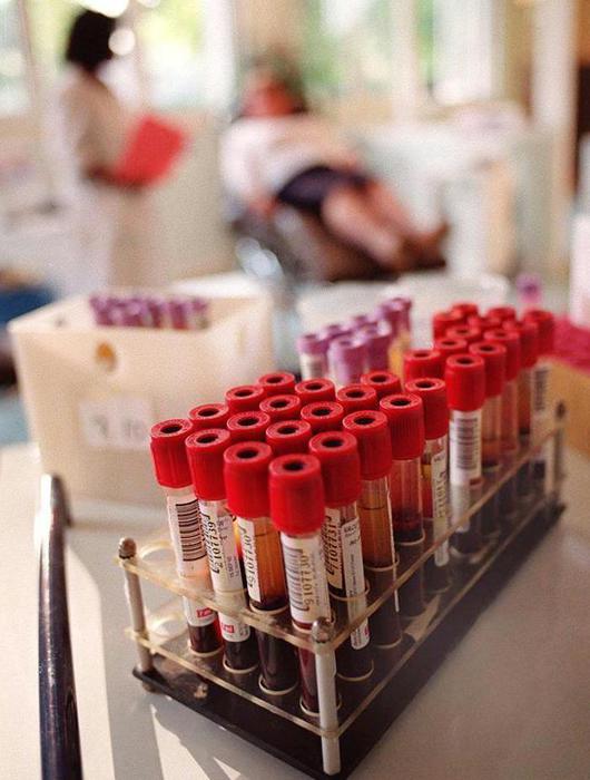 Ematologia: tumori rari,vita ricomincia da un esame sangue