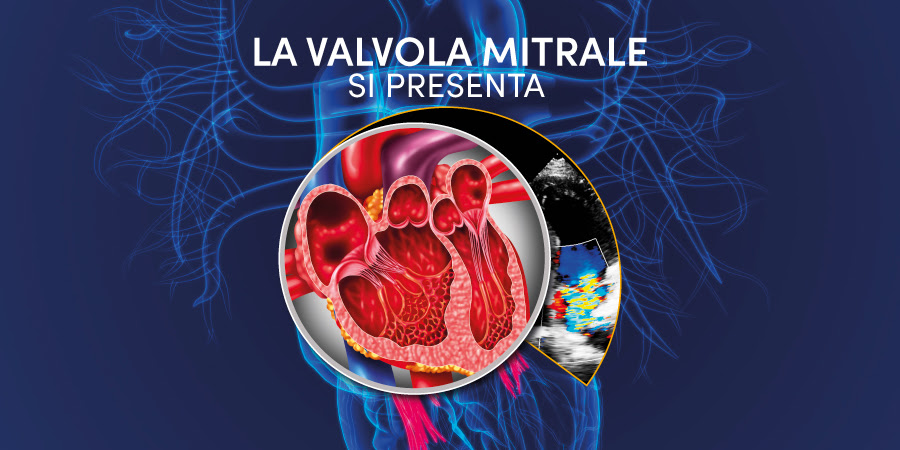 Cardiologia mini-invasiva: le nuove frontiere per il trattamento dell’insufficienza mitralica