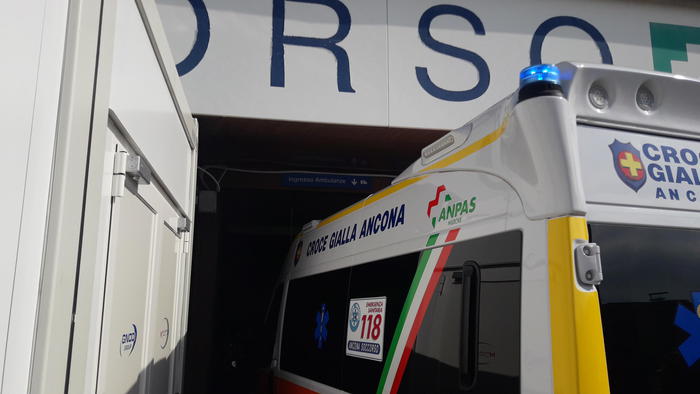 Vaiolo scimmie: caso sospetto ad Ancona, 24enne ricoverata