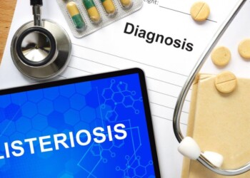 Allerta Listeria: massima attenzione al cibo