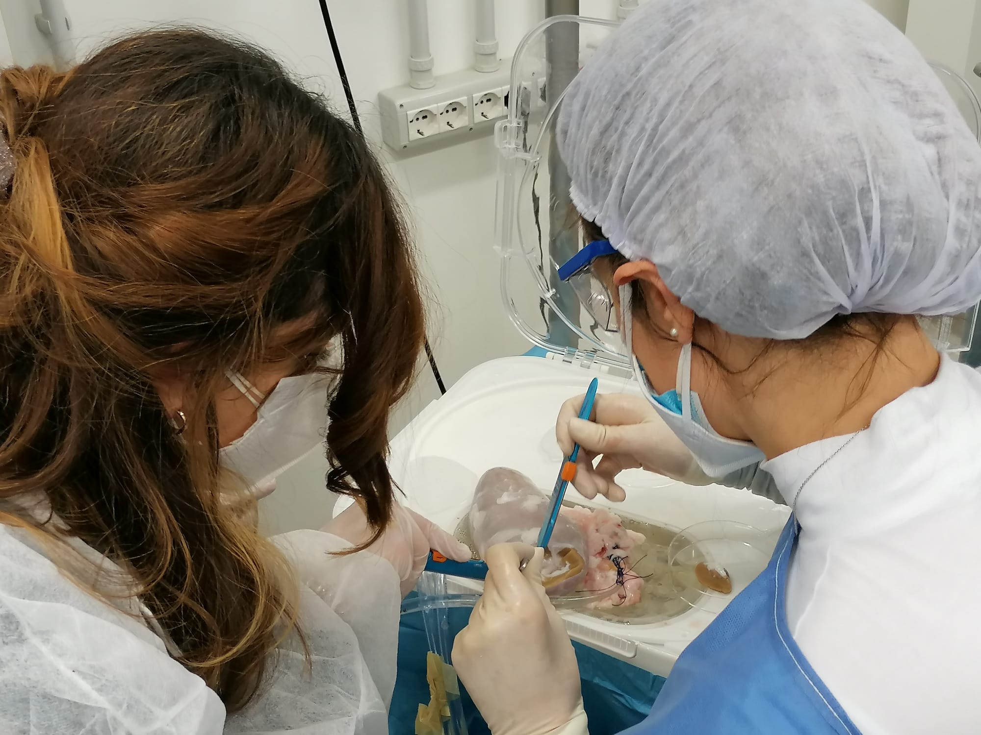 Trapianto: oltre 50 interventi realizzati in Italia e nel mondo nel 2022 con i sistemi Aferetica