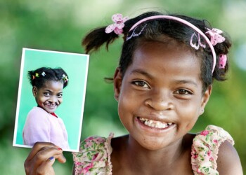 Vino & Charity: un evento Operation Smile, per donare sorrisi