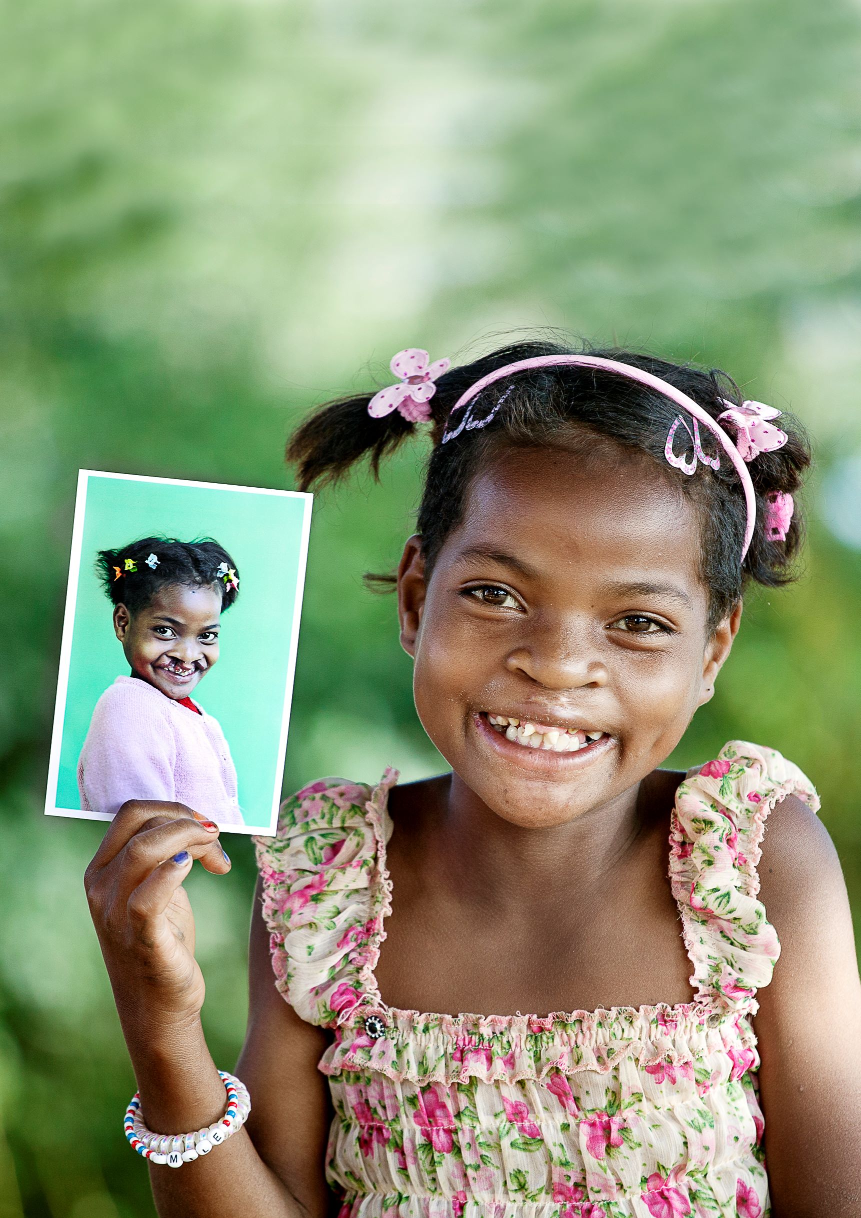 Vino & Charity: un evento Operation Smile, per donare sorrisi