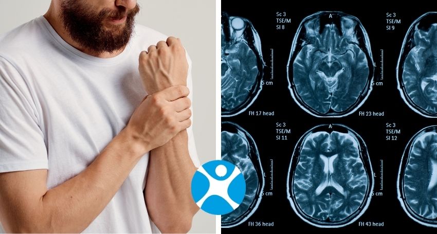 Atrofia Muscolare Spinale