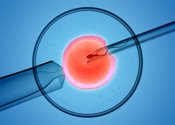 Strada per un Sogno ONLUS