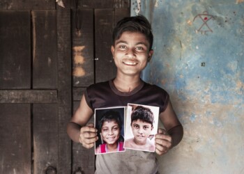 Al via “Sorrido perché”, la Campagna di Operation Smile per donare cure a chi nasce con una malformazione del volto