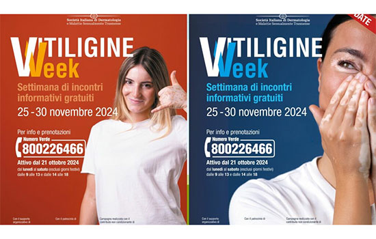 Vitiligine Week